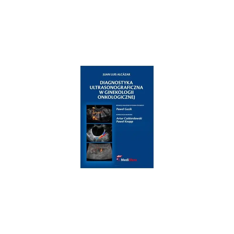 Sprawdź teraz Diagnostyka ultrasonograficzna w ginekologii onkologicznej