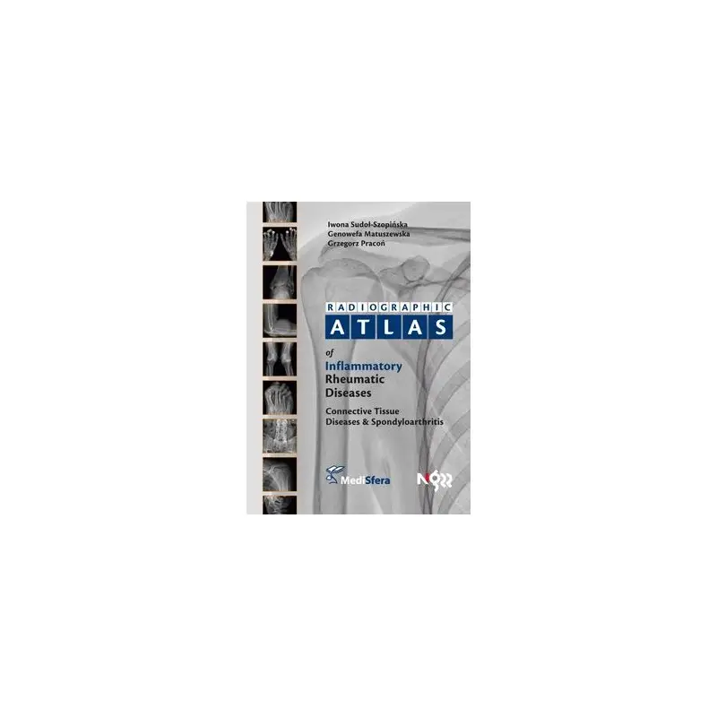 Premium Radiographic atlas of inflammatory rheumatic diseases