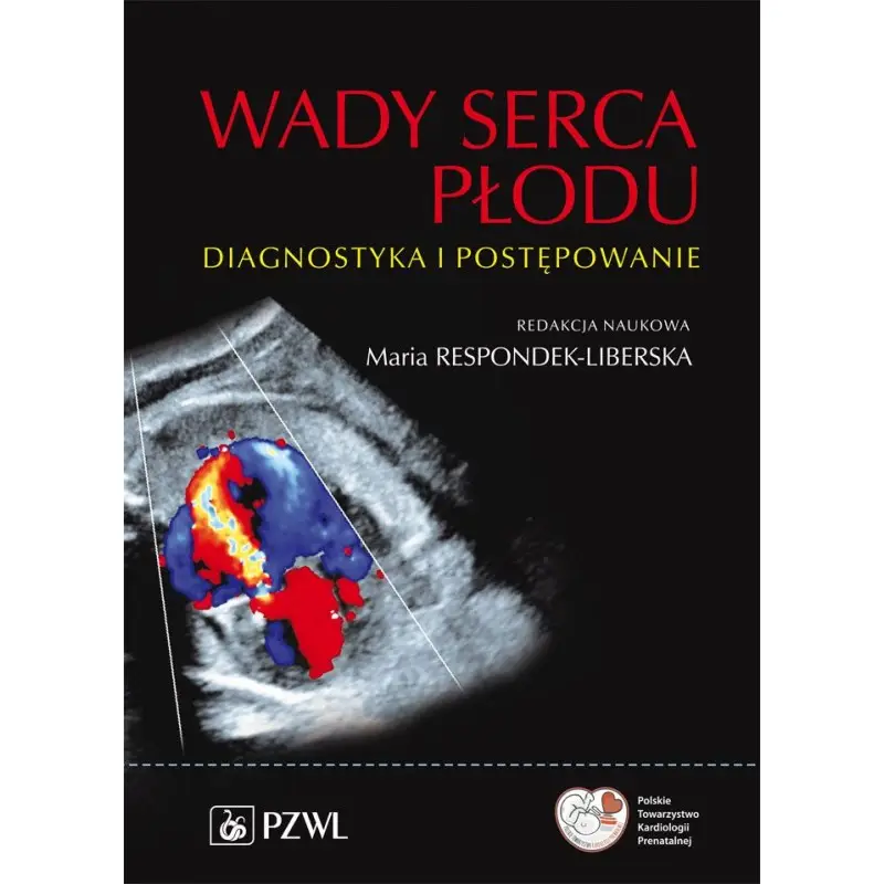 Kup teraz Wady serca płodu. Diagnostyka i postępowanie.