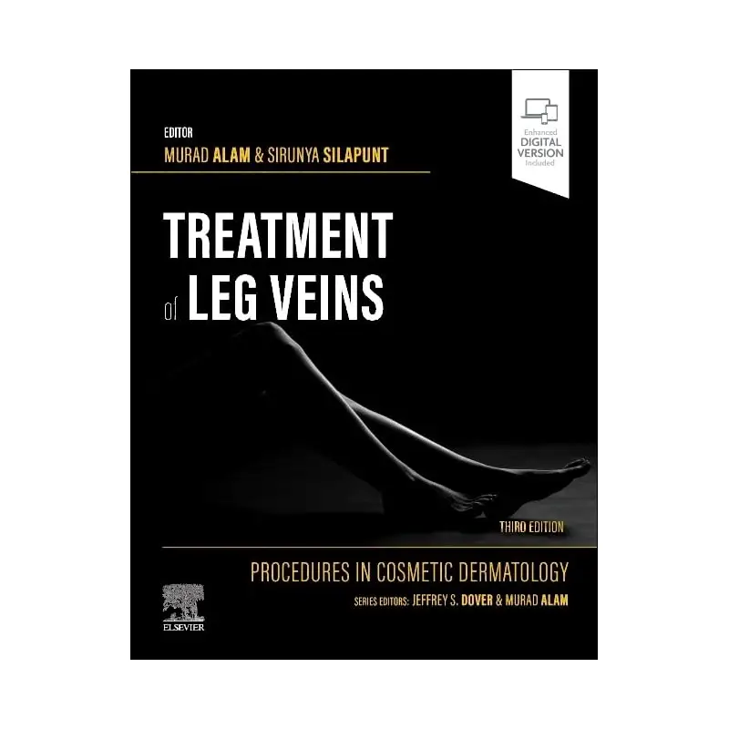 Procedures in Cosmetic Dermatology Series: Treatment of Leg Veins Kup online